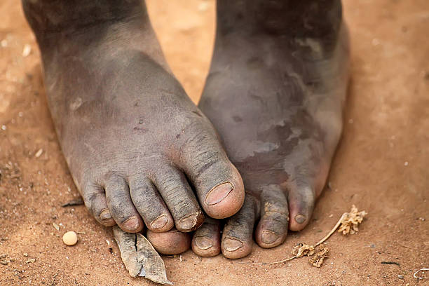 Barefoot children